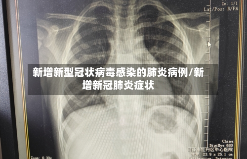 新增新型冠状病毒感染的肺炎病例/新增新冠肺炎症状