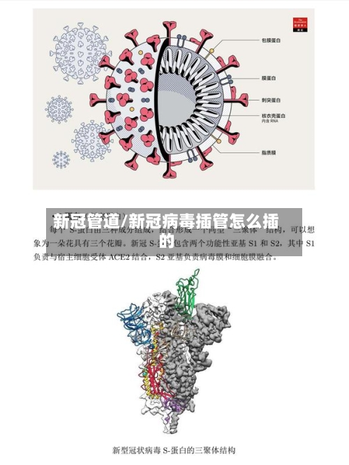 新冠管道/新冠病毒插管怎么插的-第2张图片