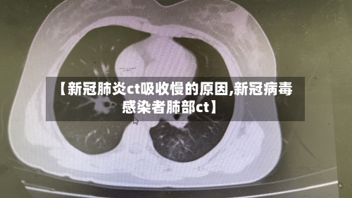【新冠肺炎ct吸收慢的原因,新冠病毒感染者肺部ct】